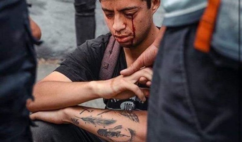 Policía de Chile está disparando a los ojos de los manifestantes para dejarlos ciegos. y