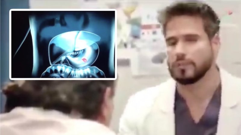 VIDEO: Serie de Televisa confunde el páncreas con el hígado.