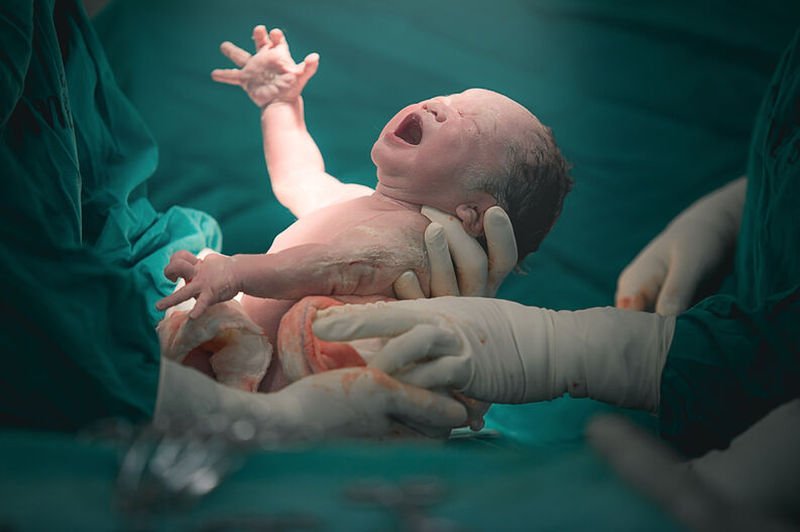 Doctor deja caer a bebé recién nacido durante parto; 