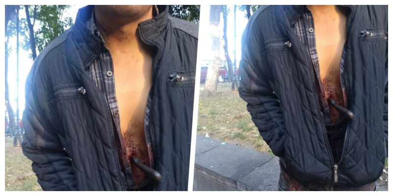 Hombre pasea con un cuchillo enterrado en el estómago en calles de la CDMXy