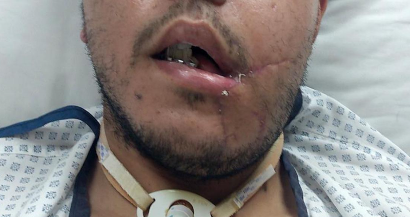 Fue de vacaciones a Guanajuato, regresó con el rostro desfigurado por una bala
