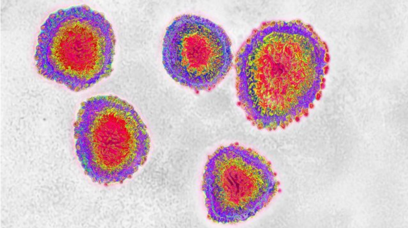 #ÚltimaHora Se registra el primer infectado por coronavirus en América