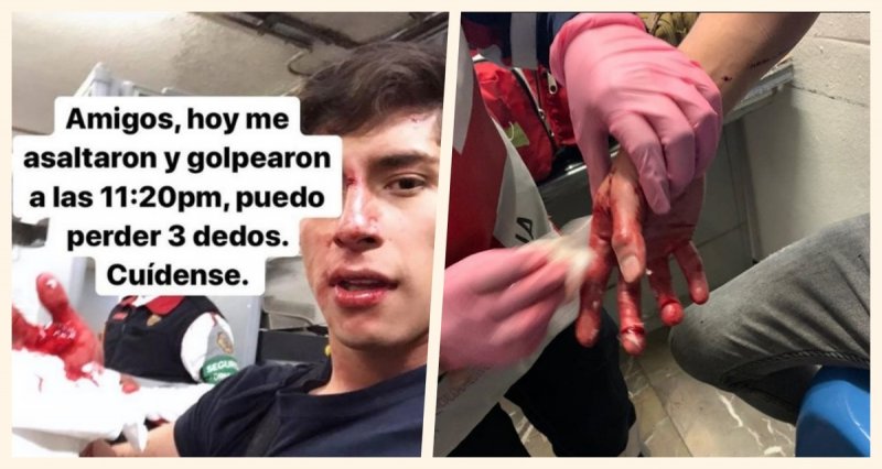 Lo asaltan, cortan sus dedos y lo golpean con un bat afuera del Metro, denuncia estudiantey