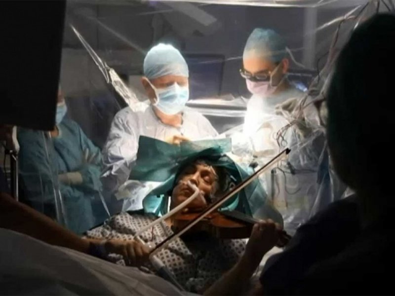 Toca el violín durante su cirugía de tumor cerebral