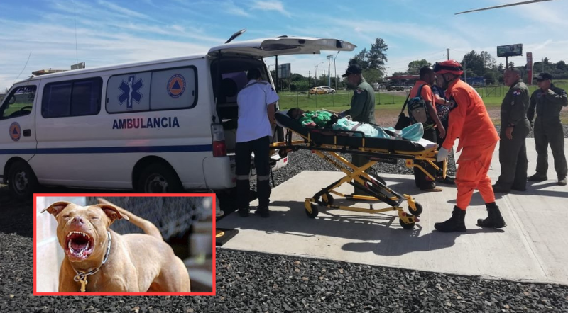 Perro pitbull ataca a mujer y le arranca la pierna en Álvaro Obregón via El Universal