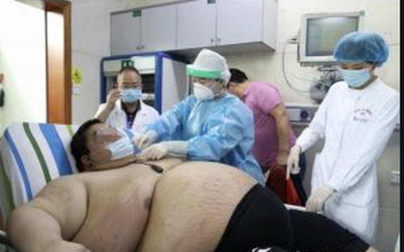 Sujeto sube más de 100 kilos tras pasar varios meses sin salir de casa por CORONAVIRUS