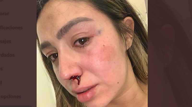 “A 33 días del parto recibí patadas”, Instagramer Melissa Suárez denuncia a su agresor