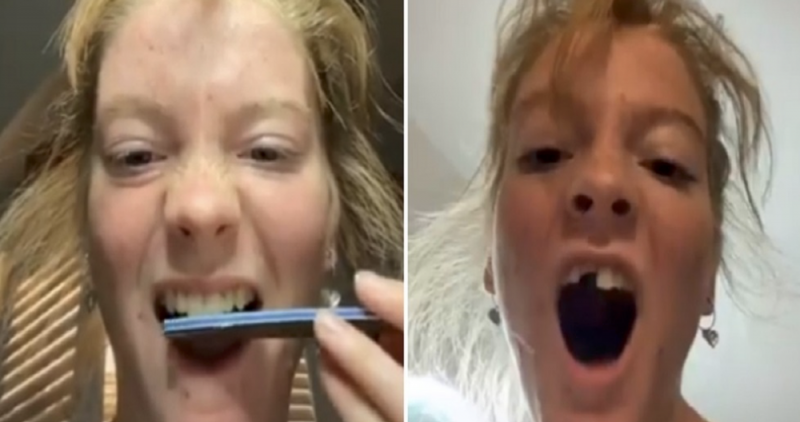¡Solo intentes! Liman sus dientes para tenerlos parejos: el peligroso reto de TikTok 