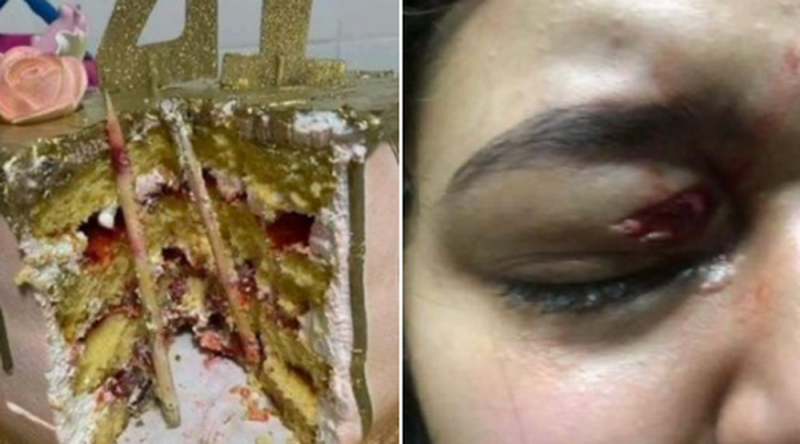 Mujer da mordida a pastel de CUMPLEAÑOS y casi pierde un ojo por esta razóny
