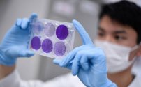 Científicos australianos descubren fármaco que mata al coronavirus en 48 horas