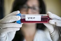 El IMSS innova con nuevo tratamiento para el VIH sin costo al derechohabiente