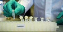 Médicos de NL inician pruebas para curar el coronavirus con plasma de paciente recuperando